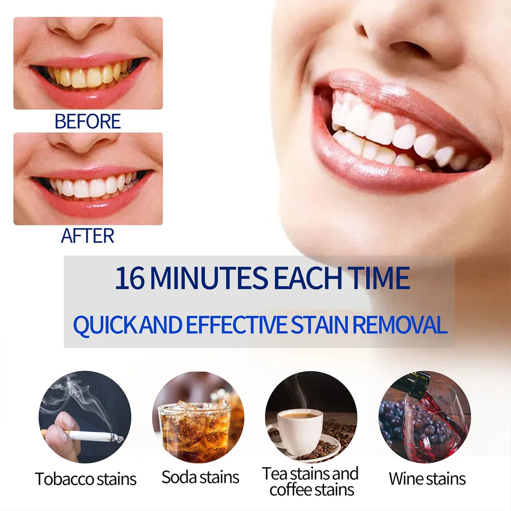 Teeth Whitening LED Kit ✨ | Bright Smile in Minutes