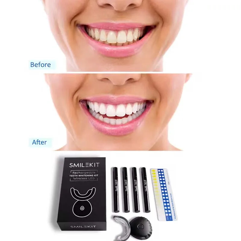 Wireless Teeth Whitening Kit with LED Light ✨ | Professional Results at Home 🦷