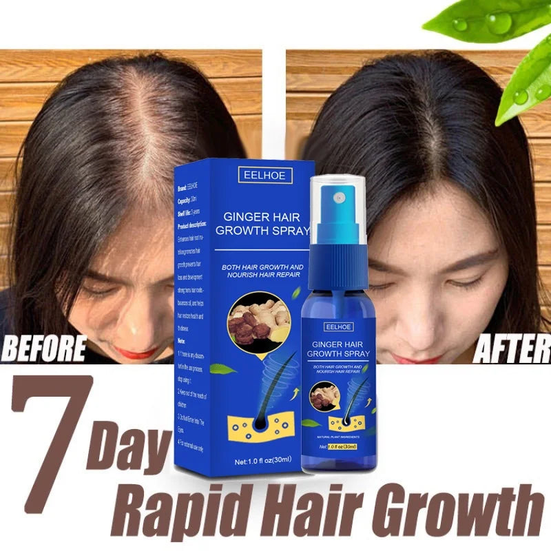 Ginger Hair Growth Spray 🌿✨ | Strengthen Hair & Reduce Hair Loss Naturally